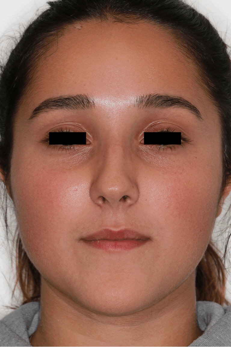 Chirurgie maxillo-faciale et stomatologie 17 Design sans titre 1 1