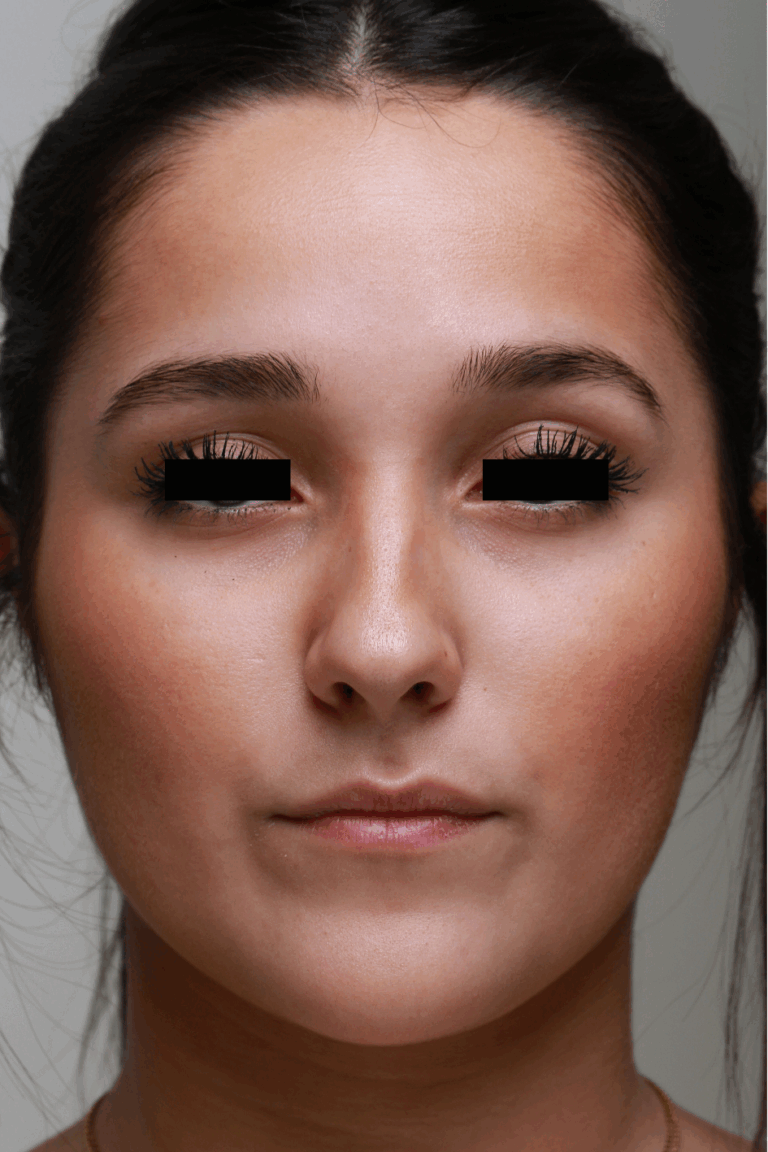 Chirurgie maxillo-faciale et stomatologie 18 test 2